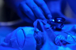Недоношена дитина в інкубаторі в лікарні в Запоріжжі. Українські організації повідомляють про поодинокі випадки зростання материнської та дитячої смертності